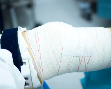 Arthroscopy Procedure