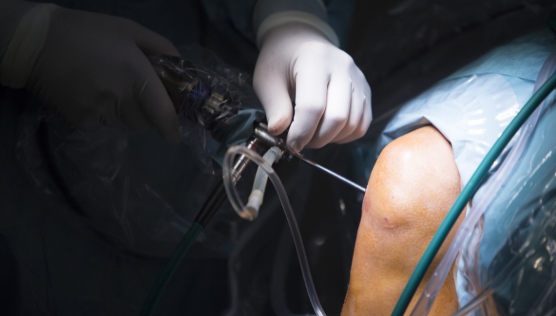 Arthroscopy