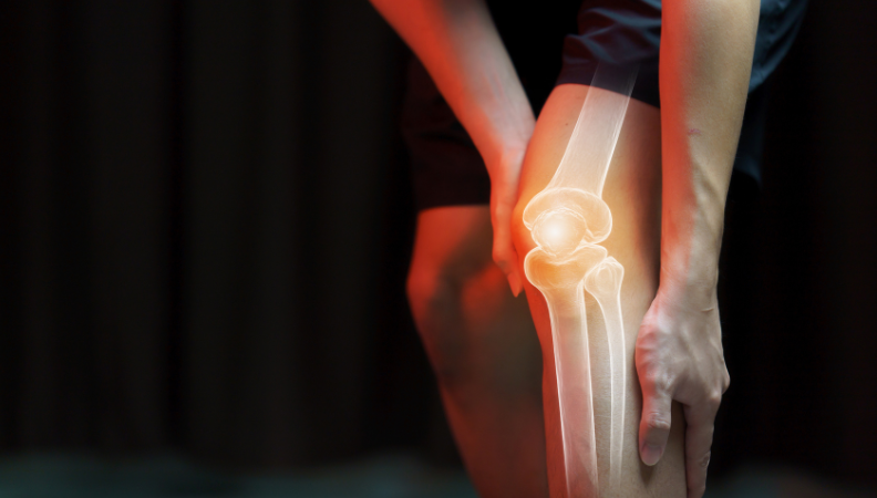 Total Knee Replacement Surgery